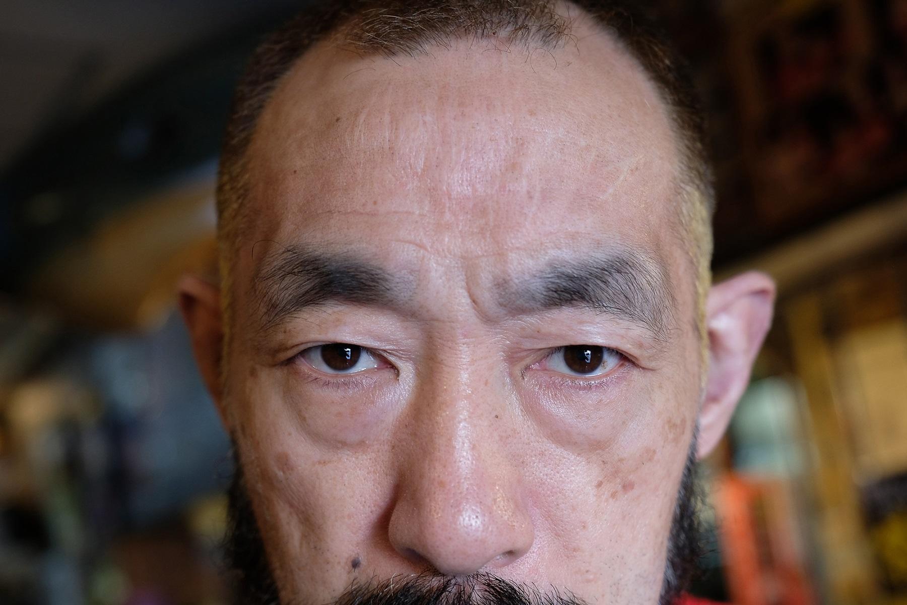 「額の傷跡は消えた」と松永さんは謙遜するが、今も傷跡は生々しく刻まれている。